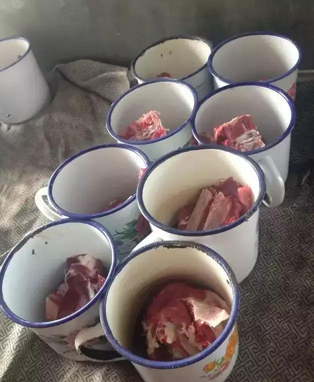 【口碑整形】新疆黎美整形许黎的超平衡网状脂肪吸脂-开云Kaiyun(图4) 开云Kaiyun官方网站